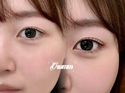 ウルム(urumm)の写真
