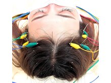 ゆうえん鍼ラボ(ゆうえん鍼Labo)/