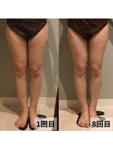 セイリキ(SEIRIKI)/★痩身ダイエットお客様のお声★