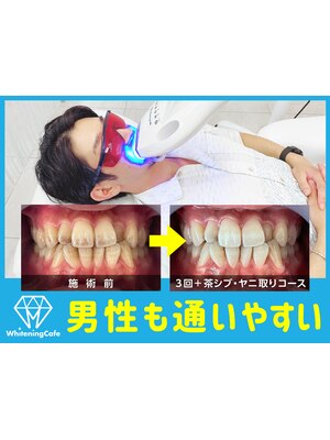歯のホワイトニングWhiteningCafe岸和田店【ホワイトニングカフェ】