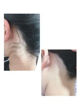 チョコア(CHOCOA)/アップスタイルもいい感じ★