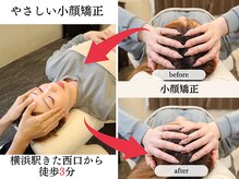 (4)施術　小顔整体・小顔矯正肩こり/頭痛/巻き肩/反り腰/小顔/骨盤矯正/横浜/整体/リンパ/マッサージ