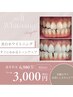 【新規限定】美白ホワイトニング　1回20分×2照射¥6,980→¥3,000