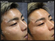 眉ラボ 京都烏丸店/メンズ眉毛サロン　眉ラボ