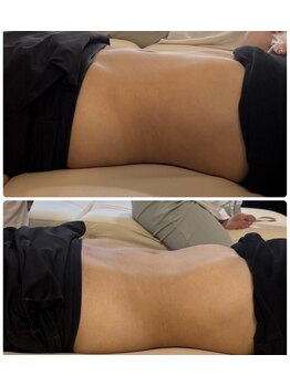 浜町しあわせ整体院/魔法の腸もみ