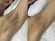 アールビューティー(R Beauty)の写真