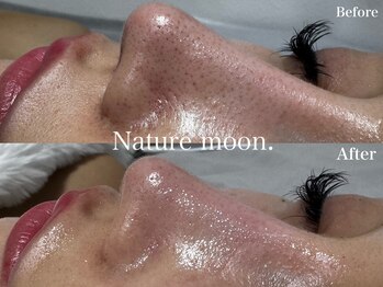 ナチュールムーン(Nature moon.)/毛穴洗浄