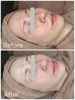 アトリエリン(Atelier Rin)/ララピール