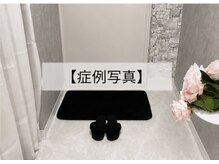 ベル 銀座(Belle)/韓国肌管理｜症例写真