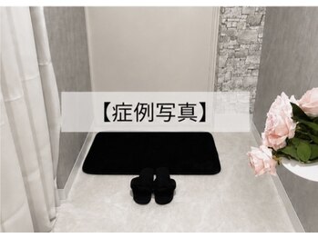ベル 銀座(Belle)/韓国肌管理｜症例写真