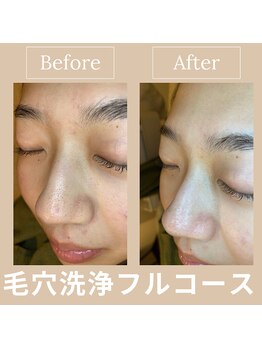 ルアナ 北谷店/毛穴洗浄毛穴ケア 《沖縄/北谷》