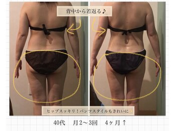 グレッセン(glanzen)/【40代/月2~3回/4ヶ月後】