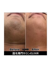エリクサー 太田店(Elixir)/before after