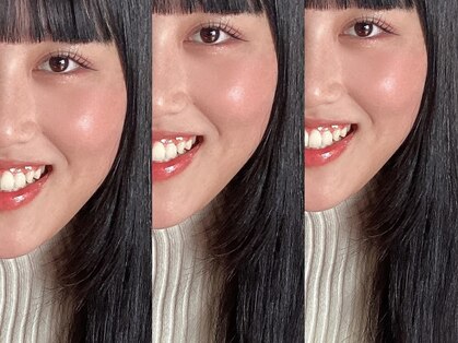 ソラ(sora)の写真