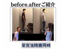 栄光治院 整体院東岡崎/岡崎/東岡崎/整体/腰痛/肩こり