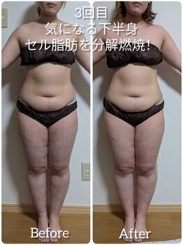 ヨサパーク アエル(YOSA PARK AELL)/3回施術後/よもぎ蒸し/痩身/整体