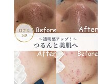 サロンケア×スキンケアで自分史上最高の韓国美肌へ。