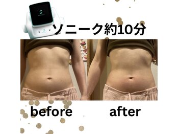 ボディデザインホームクレアフェリーチェ 神戸(Body design home Crea felice)/短時間で高効果☆痩身マシン!