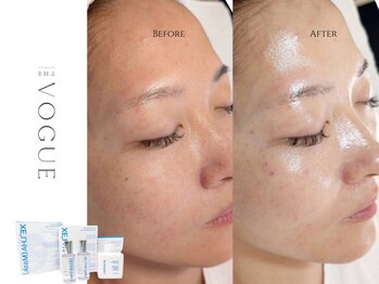 ザ ヴォーグ(the VOGUE)の写真/【結果重視エステ】上質で落ち着いた空間、肌と丁寧に向き合う時間を。大人女性のための美肌エステを。