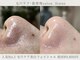 フレーズ(fraise)の写真