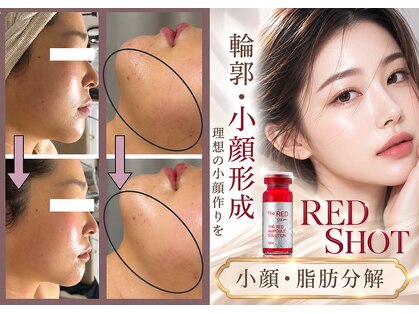ルーセントの写真