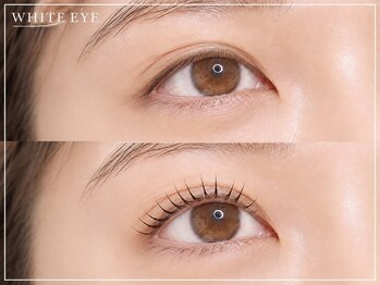 ホワイトアイ 麻布十番(WHITE EYE)の写真/《当店人気No.1★》顔脱毛で美白効果も◎【アイブロウ+フェイスWAX(額orフェイスライン)1回￥5480】