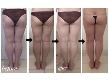 美人バスト 名古屋店/【痩身・ダイエット】 名古屋/脚