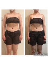 コハルチア(KohaLucia)/月2回全8ヶ月＊Before/After