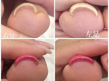 ラルーナ(La Luna)