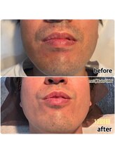 シンバ 倉敷店(SIMBA)/