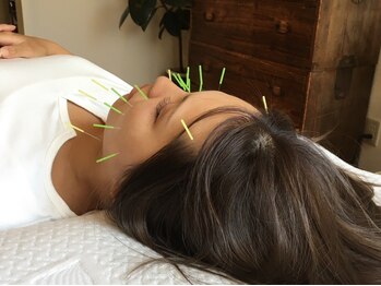 ひだまり鍼灸整骨院/施術