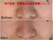 ちゅるん肌ドットコム 梅田店(ちゅるん肌.com)の雰囲気（小顔やお肌のお悩み、見た目のコンプレックス全部ご相談下さい♪）