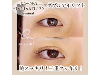 アイビューティー 三荻野店(AI beauty)/ダブルアイリフト/まつ毛パーマ