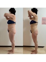 パピヨン(Papillon)/50代ダイエット成功◎