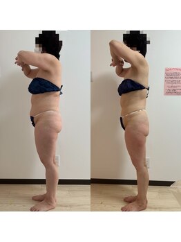 パピヨン(Papillon)/50代ダイエット成功◎