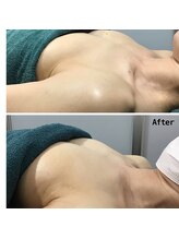 プリンセス バイ セイフティプリンセス 長野店(PRINCESS)/《バストアップ》