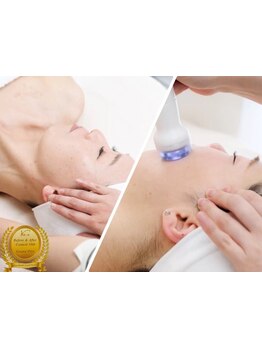 小顔になりたい