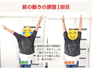 掛川整体院サウレ/軽くスッと上がる肩へ