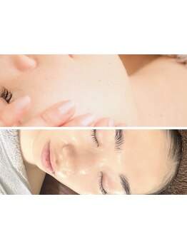 ハリツヤをUPしたい