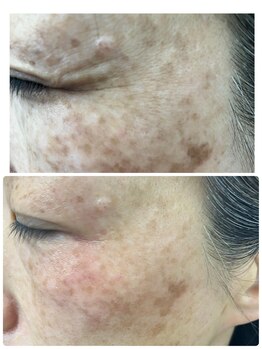 フィオリトゥーラ ガーデン 茨木店/ビフォーアフター