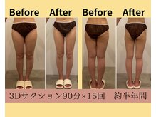 メゾンワン(maison one)/【　下半身痩せもお任せ　】