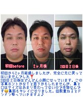 ハーボプラス(THE HEARBO plus)/私から見ても嘘みたいです