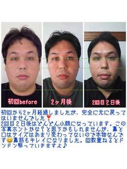 ハーボプラス(THE HEARBO plus)/私から見ても嘘みたいです