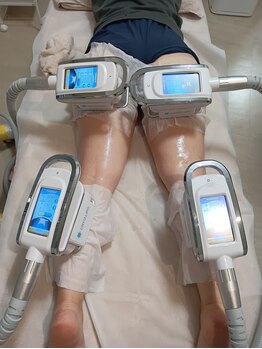 ホワイトビューティーラボ(White Beauty Lab)/【痩身】脂肪冷却４カップ