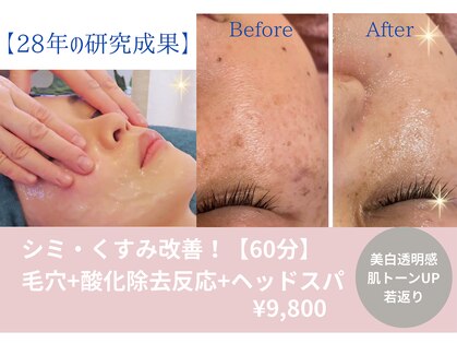 マインドエステ 仙台店(mindエステ)の写真
