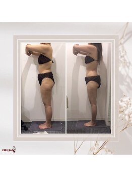 効くラボ 梅田店/1ヶ月でこの変化！全身120分痩身