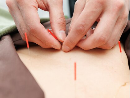 いむき整骨院・いむき鍼灸院の写真