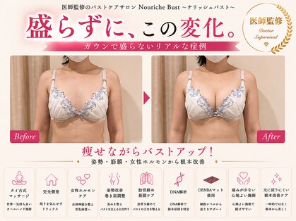 ナリッシュバスト(Nouriche Bust)の写真