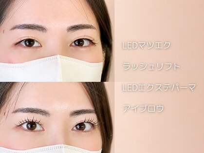 ヌイ(nui)の写真