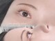 ソミ(SOMI)の写真
